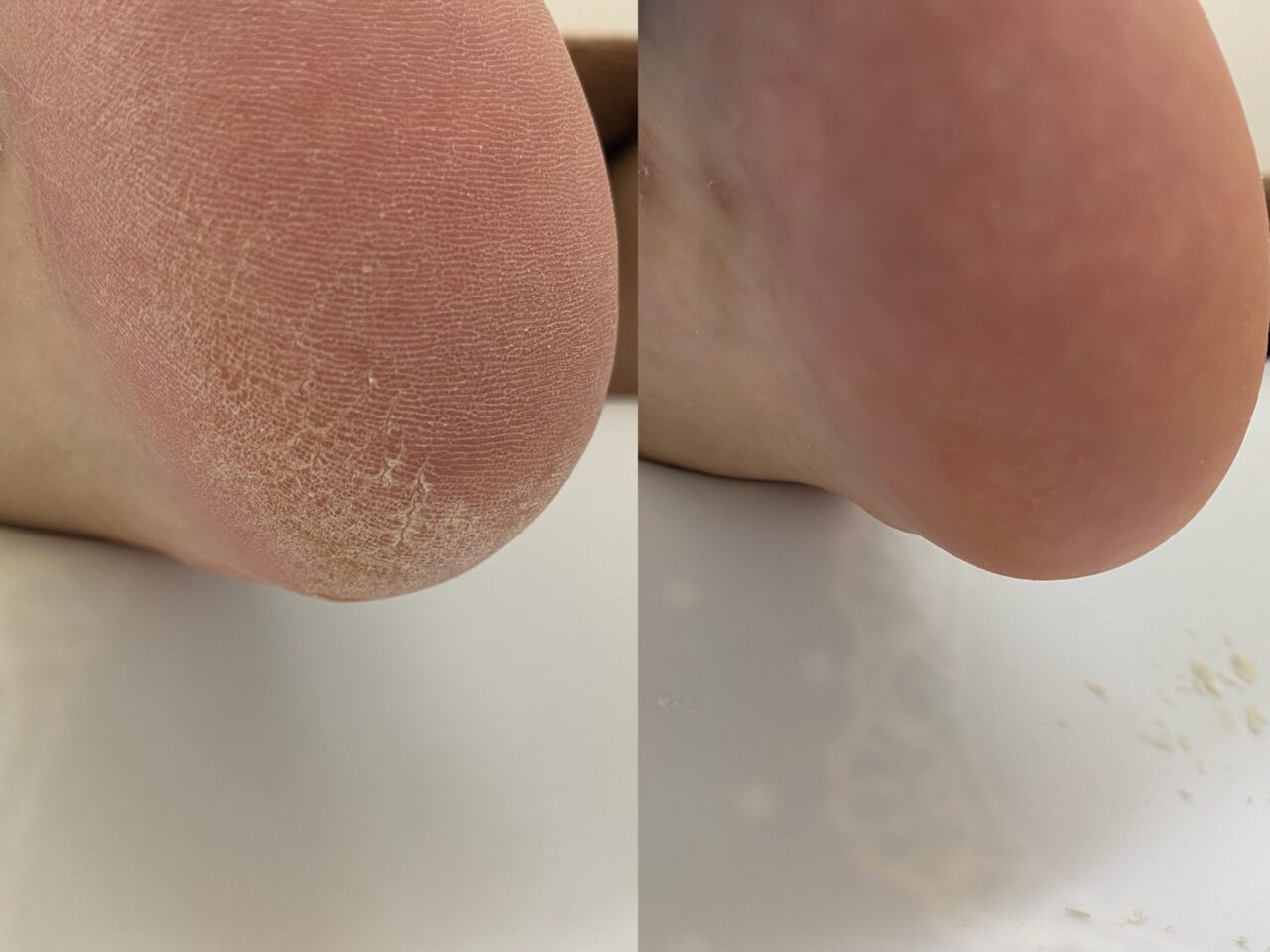 ゲンキノモト。フットケアラボ